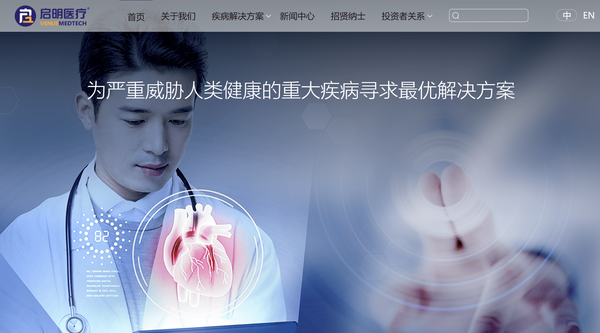 启明医疗企业,心脏瓣膜微创介入治疗厂商